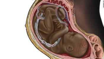 ilustracion feto negro