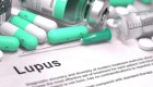 ¿Qué síntomas presentan quienes padecen de lupus?
