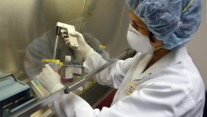 pruebas detección viruela mono