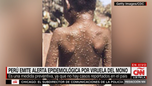 Perú emite alerta epidemiológica por viruela del mono redaccion mexico 