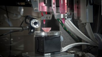 órganos impresos 3D trasplantes