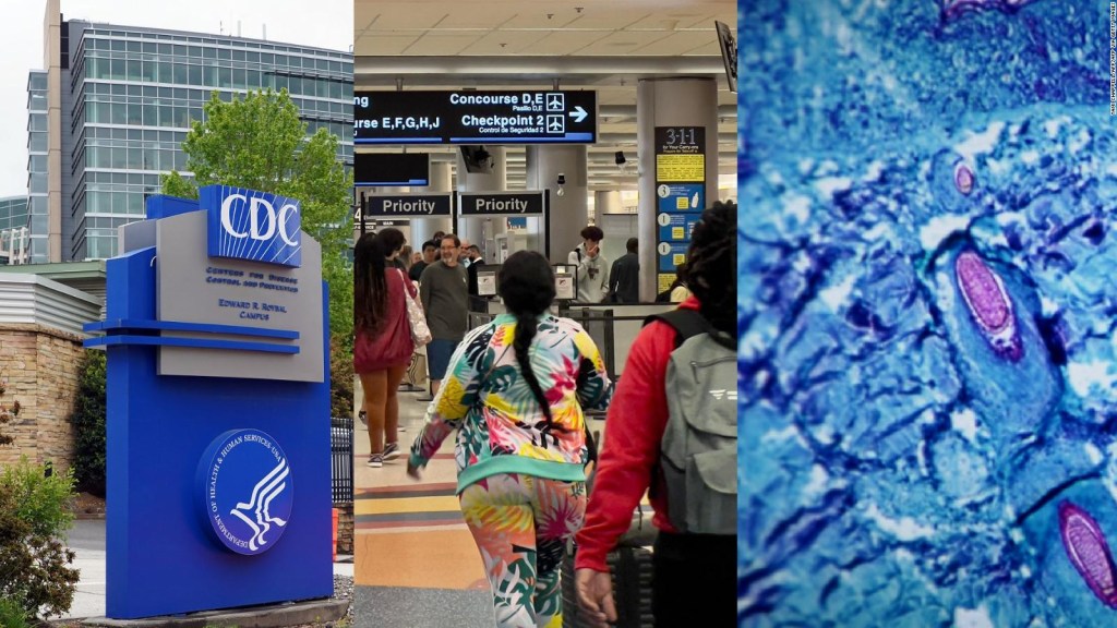 CDC Monkeypox Advisory for Travelers