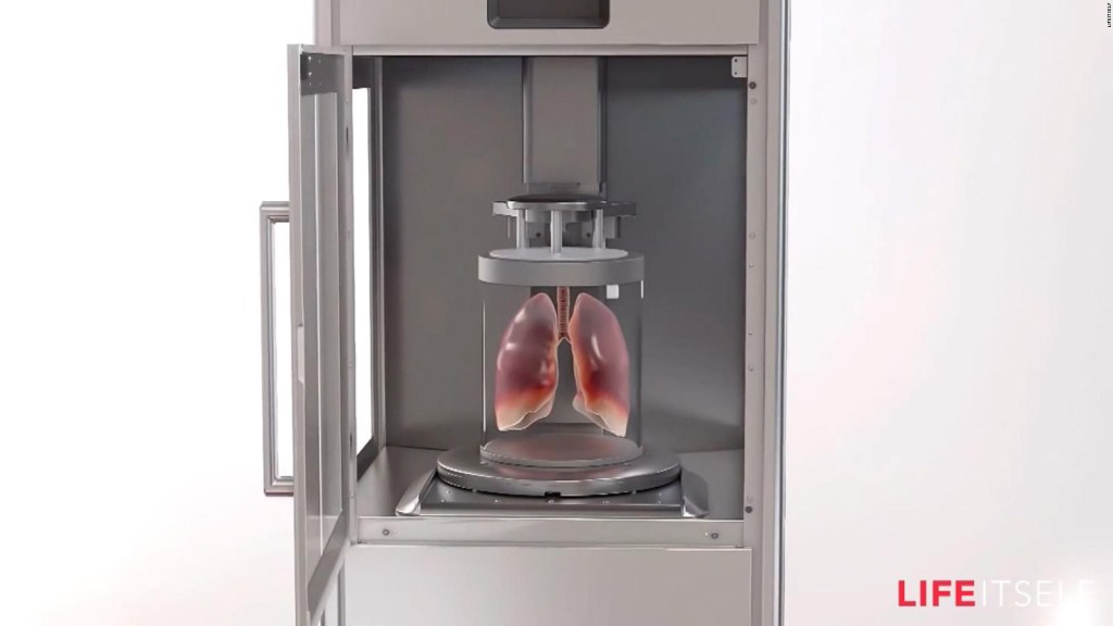 3D bioprinting of organs may be possible within a decade