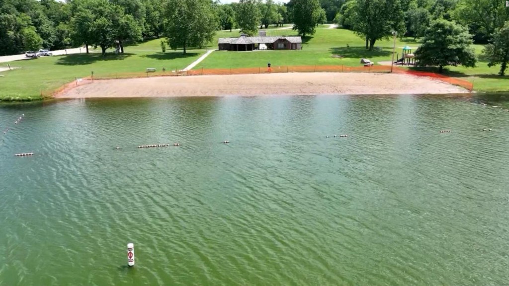 They close a beach in the US after a case of brain-eating amoeba