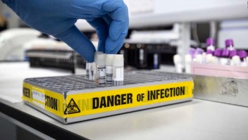 ¿Cuáles son los síntomas del virus mortal de Marburgo?