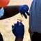 EE.UU.: Vacunas limitadas contra la viruela símica