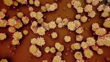 EE.UU. declara a viruela símica como emergencia de salud