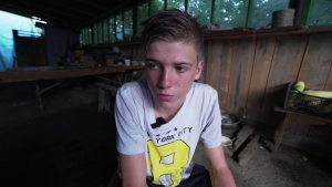 Adolescente muestra sus heridas por la guerra en Ucrania