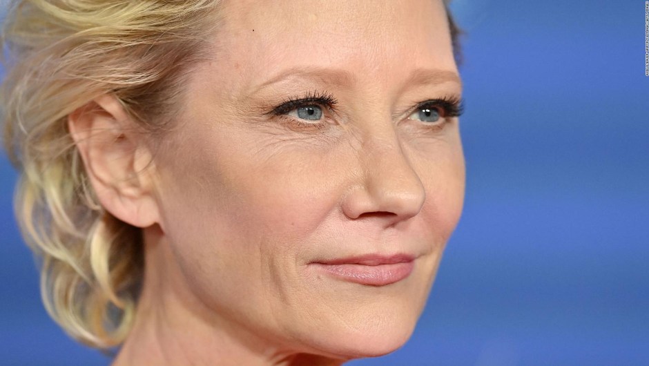 Actress Anne Heche Has A 'Long Recovery Ahead' After Car Accident