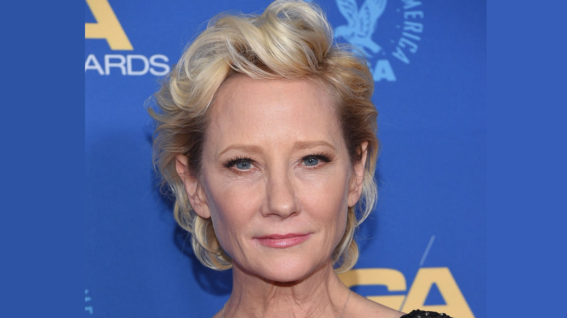 Anne Heche is in a coma in critical condition after accident - Archyde