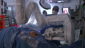 ¿Qué beneficios promete cirugía robótica vs. cáncer de próstata?