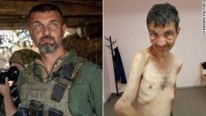 Impresionantes imágenes de soldado ucraniano que sobrevivió al cautiverio ruso