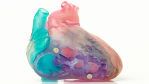 Salvan la vida de un bebé gracias a una imagen 3D de su corazón