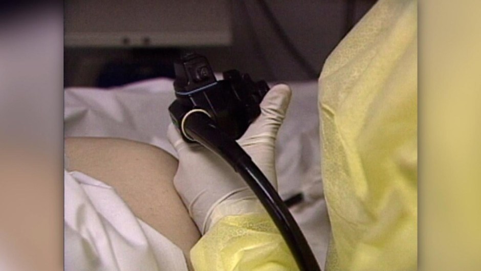 Estudio: La colonoscopia podría reducir muertes por cáncer en un 50%
