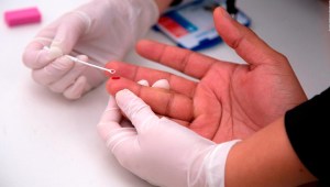 EE.UU. sufre más de 30.000 infecciones por VIH al año, dice doctor