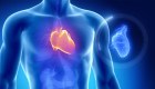 Estos 8 factores ponen en riesgo la salud de tu corazón