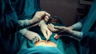 ¿Cuáles son las cirugías estéticas más populares en el mundo?