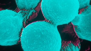 La mayoría de las personas expuestas al cryptococcus neoformans no enferman, pero algunas sí. (Crédito: BSIP/Universal Images/Getty Images)
