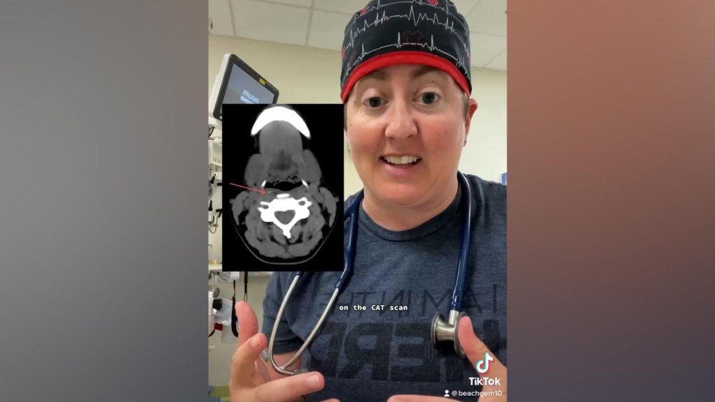 Doctor narrates on TikTok what she discovered in a 4-year-old boy after a barbecue