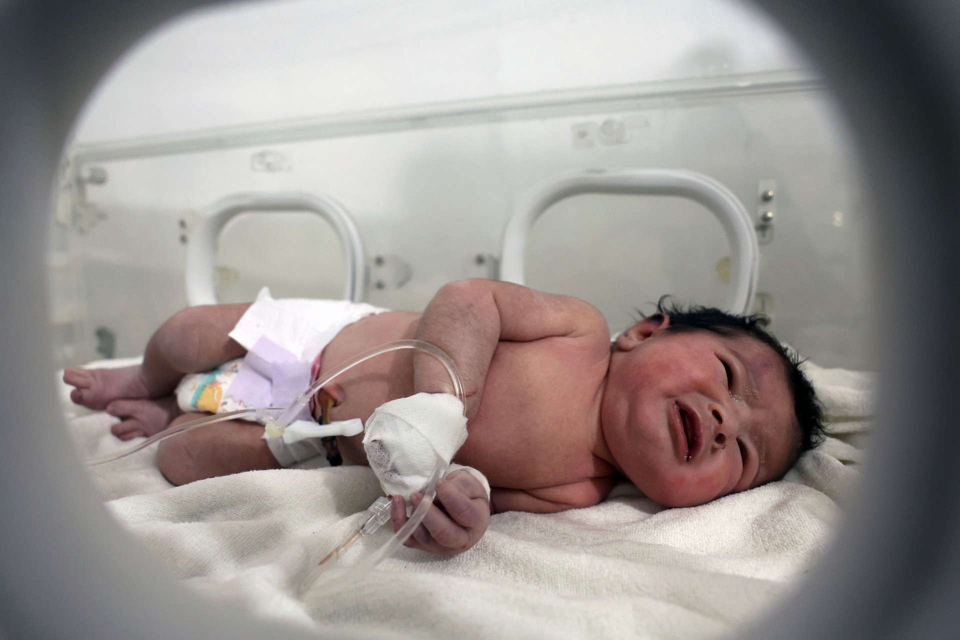 Una niña que fue rescatada recibe tratamiento dentro de una incubadora en un hospital en Afrin, Siria, este martes. (Ghaith Alsayed/AP)