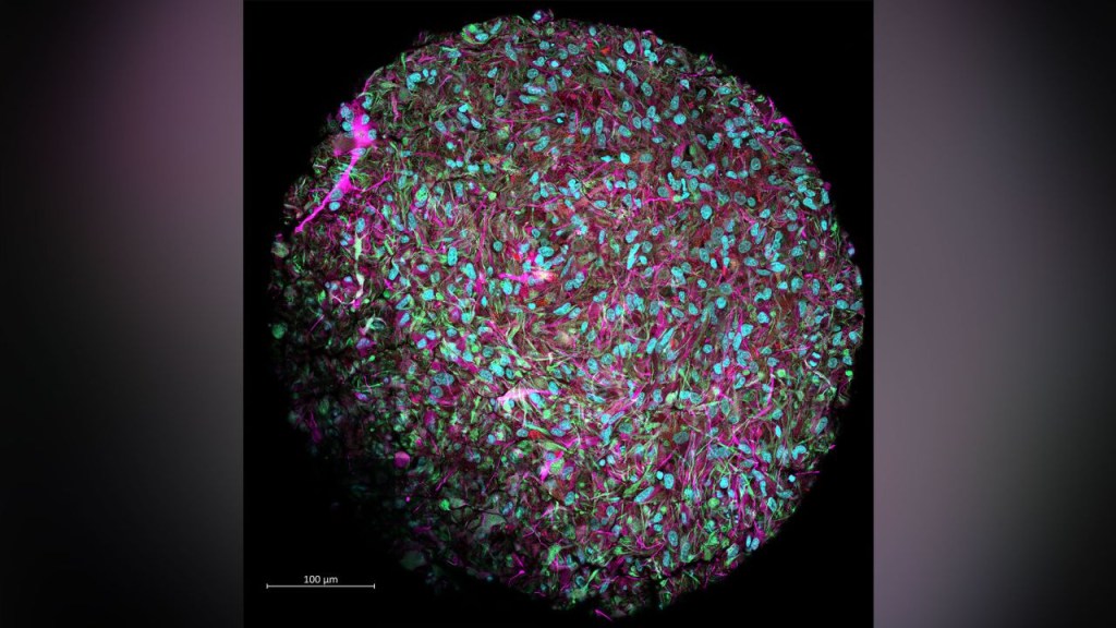 Esta imagen ampliada muestra un organoide cerebral producido en el laboratorio de Hartung. El cultivo se tiñó para mostrar las neuronas en magenta, los núcleos celulares en azul y otras células de soporte en rojo y verde. (Cortesía: Jesse Plotkin/Universidad Johns Hopkins)