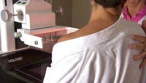 Mamografías deberán informar sobre densidad de las mamas