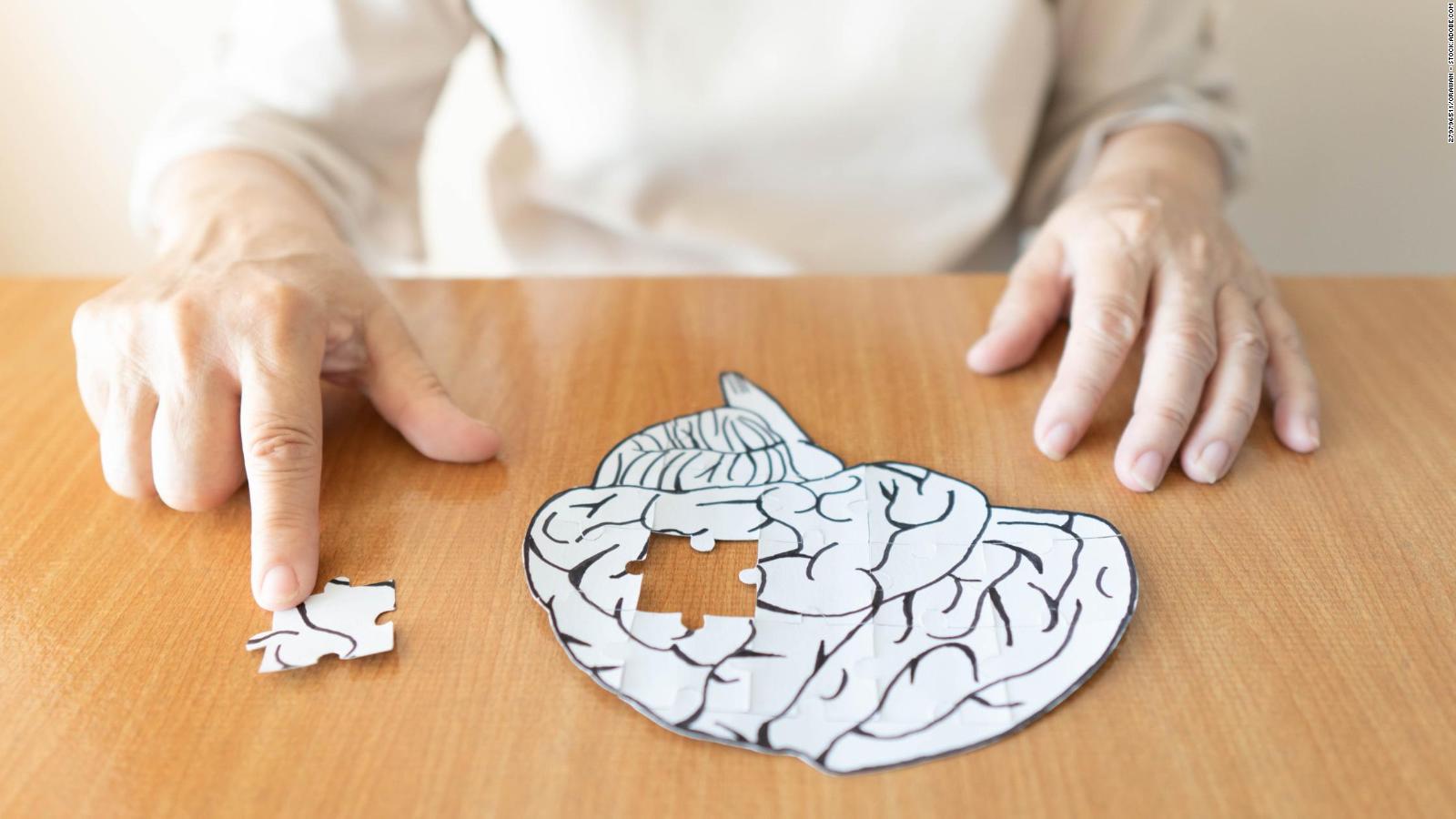 ¿Por qué la dieta mediterránea y MIND reducen los signos de la enfermedad de Alzheimer?
