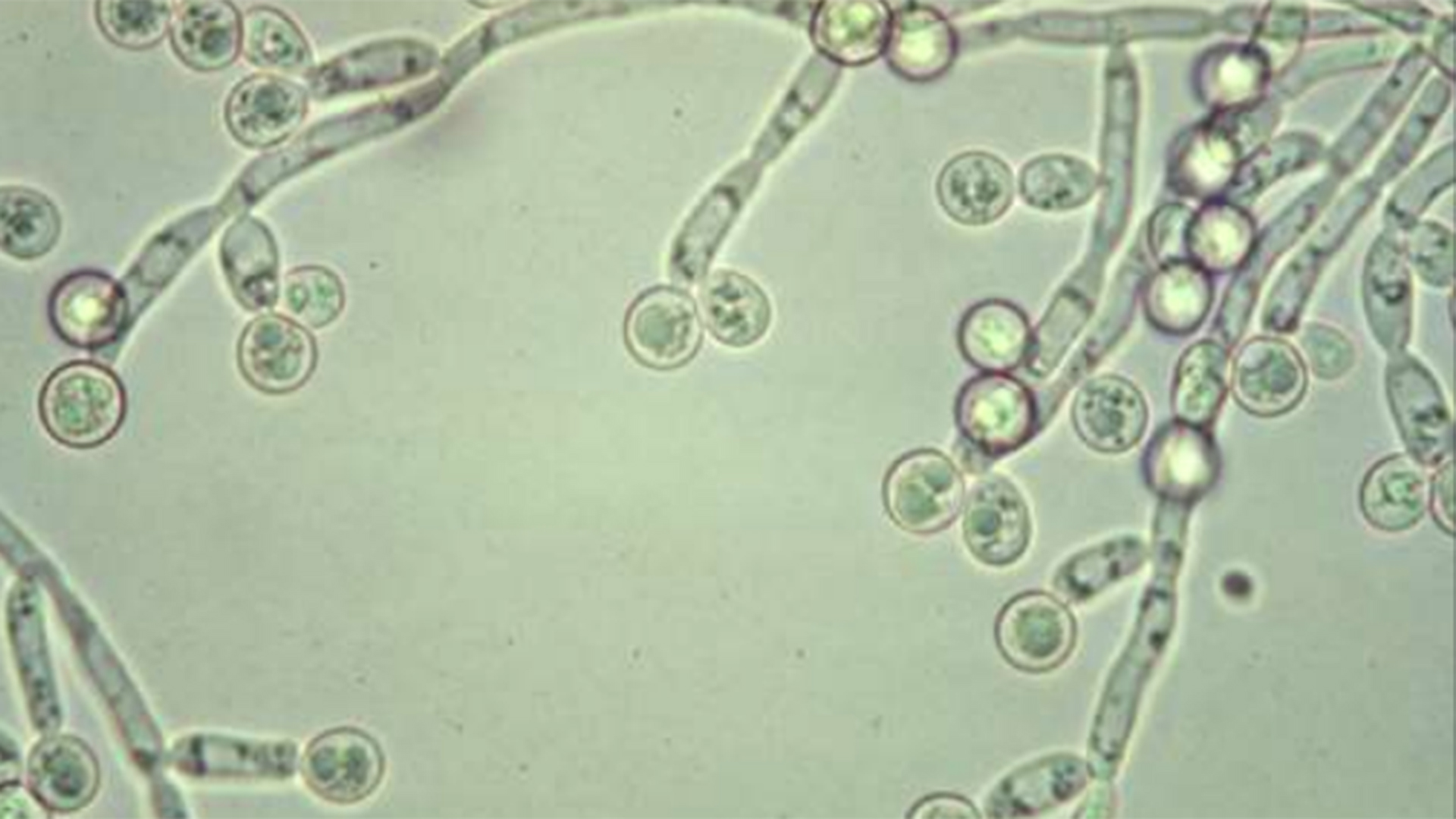 Дрожжеподобные грибы candida. Дрожжеподобный гриб Candida albicans. Грибы кандида микроскопия. Грибы кандида альбиканс микроскопия. Грибы кандида микробиология.