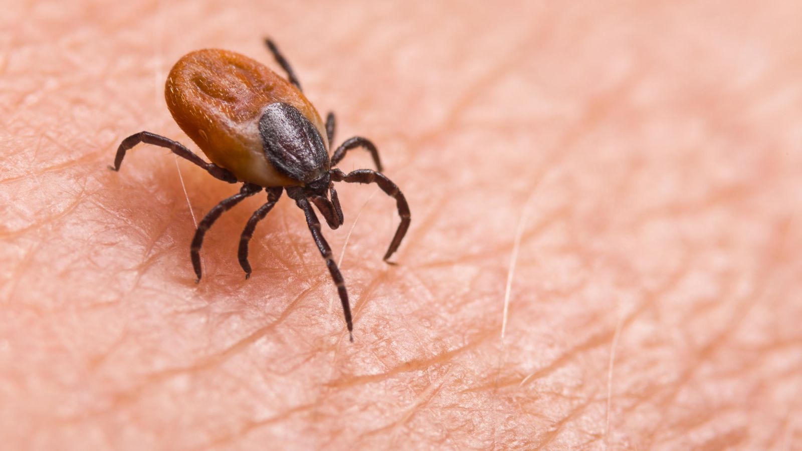 Tick-borne babesiosis on the rise in northeastern US, CDC warns