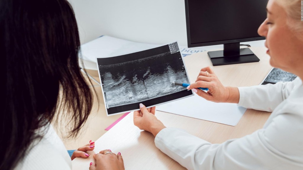 ¿Qué debe tomarse en cuenta para hacerse una mamografía a temprana edad?