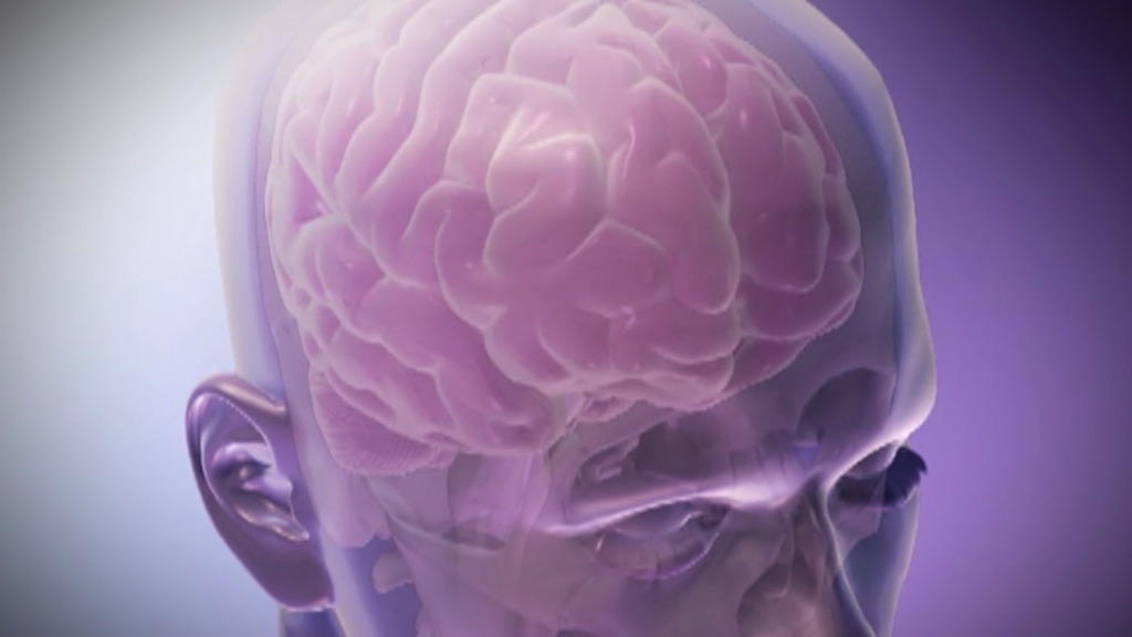 La investigación revela los efectos a largo plazo de las lesiones cerebrales