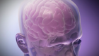 Investigación revela efectos a largo plazo de las lesiones cerebrales