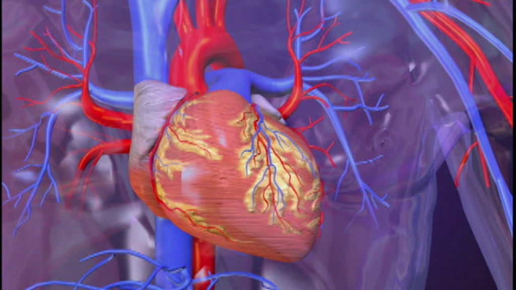 ¿Qué es un ataque al corazón y qué síntomas pueden alertarte?