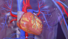 ¿Qué es un ataque al corazón y qué síntomas pueden alertarte?