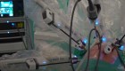Innovador en trasplante pulmonar robótico en España