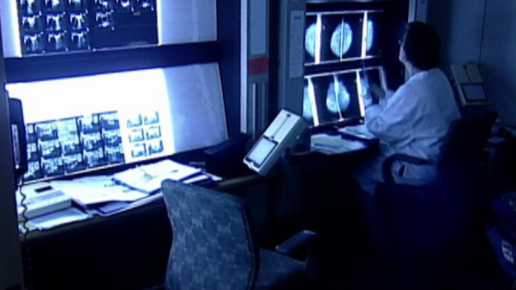 Los expertos sugieren que las mujeres se hagan mamografías desde los 40 años