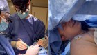 Paciente canta la banda sonora de "Moana" durante cirugía cerebral