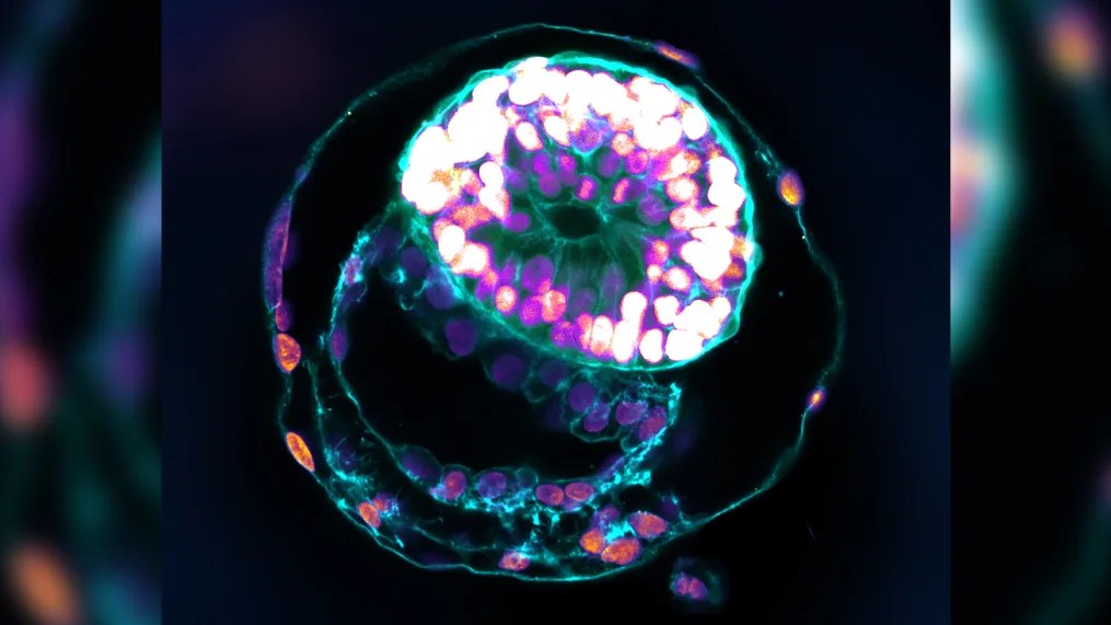 modelo de embrión humano