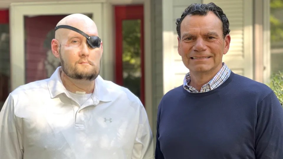 Transplantasi mata dan wajah pertama di dunia memberikan harapan baru bagi pria Arkansas