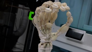 Imprimen una mano 3D con huesos, ligamentos y tendones