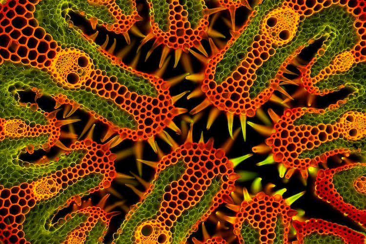 Este inusualmente colorido pedazo de pasto marino ganó la categoría de Micro. (Gerhard Vlcek/cupoty.com)