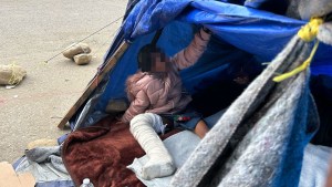 Un trabajador humanitario dijo que agentes de la Patrulla Fronteriza dejaron a una niña de 11 años con una pierna enyesada en un campamento fronterizo en California. CNN ha ocultado una parte de esta imagen para proteger la identidad de la menor. (Cortesía de Adriana Jasso/AFSC)