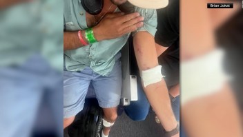 Decenas de heridos en un vuelo de LATAM tras caída repentina en el aire