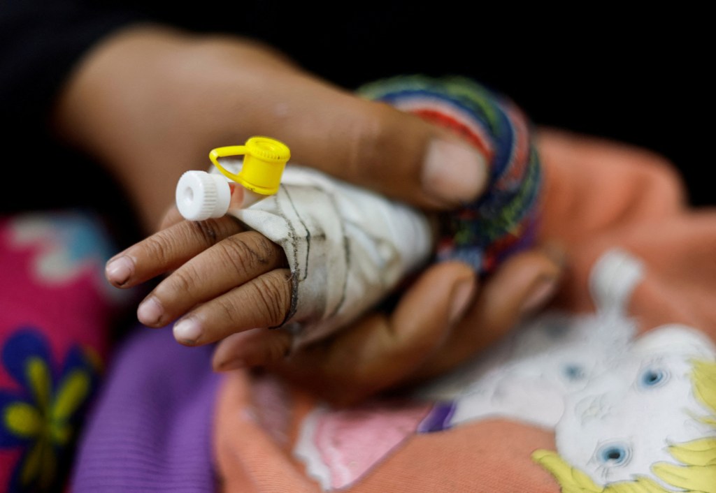 Un niño palestino que sufre desnutrición recibe tratamiento en un centro de salud en Rafah, en el sur de Gaza, el 4 de marzo. Los niños y las madres se encuentran entre los que corren mayor riesgo de sufrir desnutrición grave. (Mohamed Salem/Reuters)