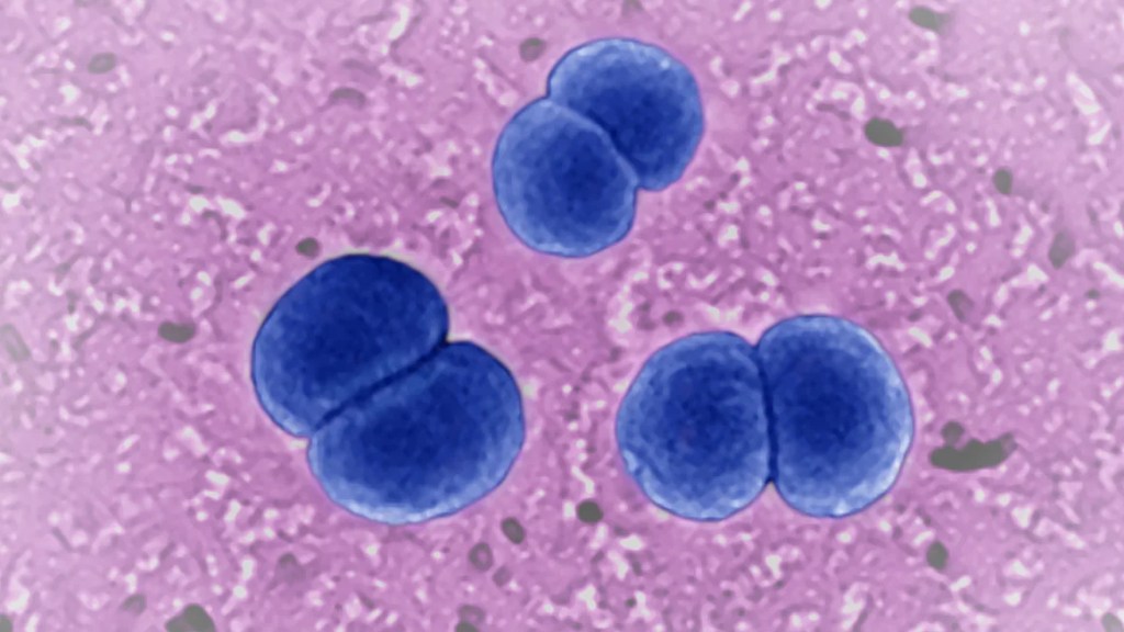 Los CDC instan a los médicos a estar atentos a ciertos tipos de infecciones raras y graves causadas por la bacteria Neisseria meningitidis. (Foto: BSIP/Grupo Universal Images/Getty Images).