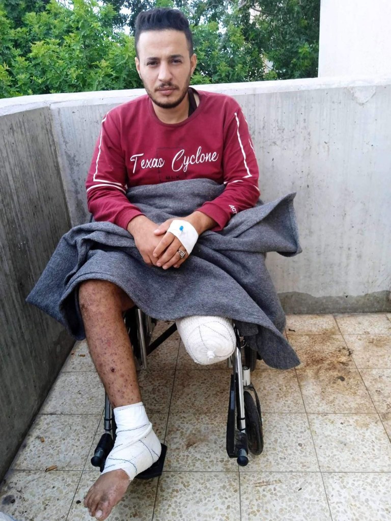 Muhammad Hassan Abu Watfa en Khan Younis, Gaza, el mes pasado. Fue gravemente herido en un ataque mientras intentaba comprar pan en el barrio de Sheikh Radwan, en el norte de Gaza, el 16 de octubre. Le amputaron dos veces el pie derecho. (Cortesía de Muhammad Hassan Abu Watfa)