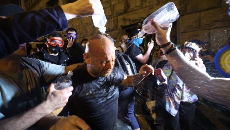 Un manifestante intenta quitarse el gas lacrimógeno de los ojos el 1 de mayo de 2024. (Crédito: Giorgi Arjevanidze/AFP/Getty Images)