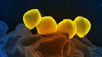 Micrografía electrónica de bacterias estreptocócicas del grupo A (Streptococcus pyogenes) en un neutrófilo humano primario. El estreptococo del grupo A es una de las principales causas del STSS. (Crédito: BSIP/Universal Images Group/Getty Images)